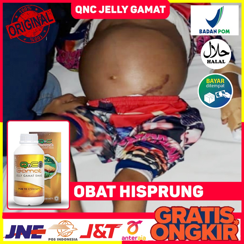 Obat Alami Hisprung - Perut Kembung | Anak-Anak & Dewasa | Qnc Jelly Gamat | Bisa Bayar di Tempat