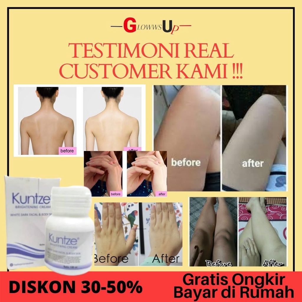 PEMUTIH BADAN KUNTZE BRIGHTENING CREAM WHITE FACIAL N BODY SKIN BRIGHTENING CREAM