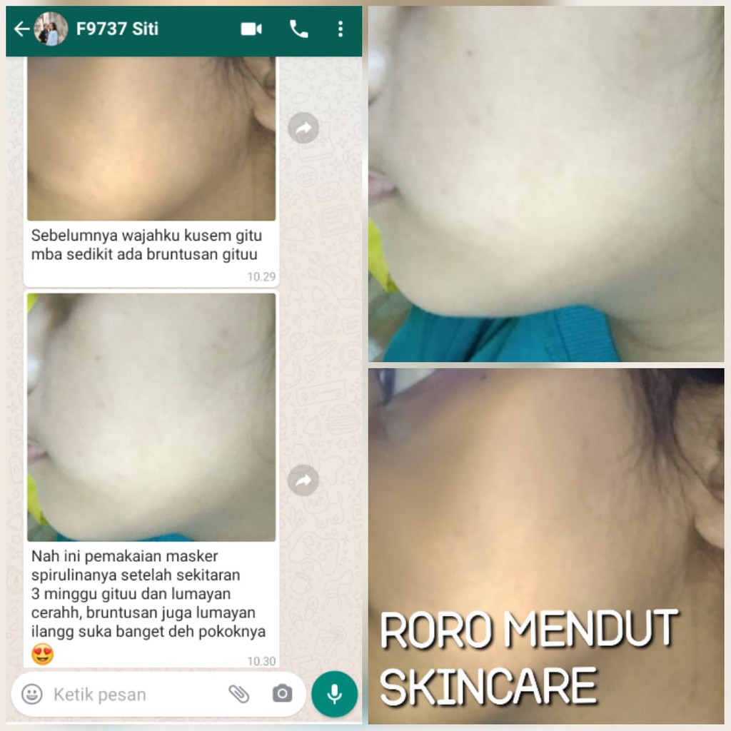 Roro Mendut Masker Spirulina Mini Size 20 gr Whitening Pemutih Wajah Penghilang Jerawat Bopeng Flek