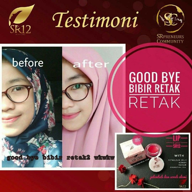 LIP CARE SR 12 PENCERAH BIBIR BPOM SR12 SKINCARE LIP BALM PELEMBAB BIBIR