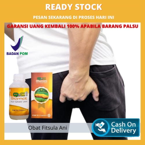 Obat Fistula Ani, Obat Nyeri Fistula Ani, Sakit Fistula Ani, Luka Fistula Ani, Mengobati Fistula Ani