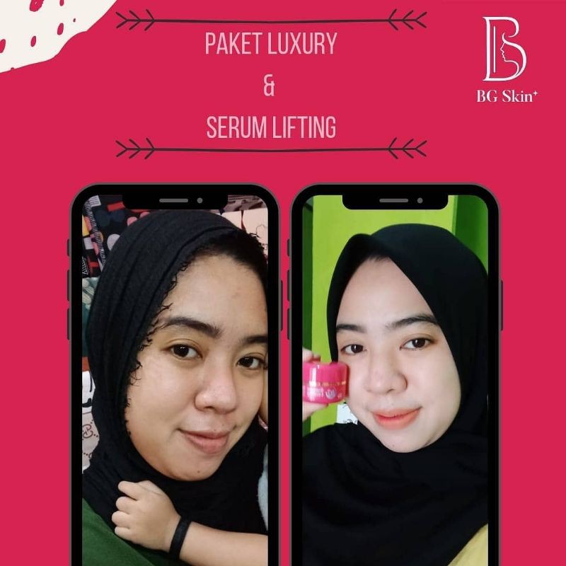 BG BEAUTY GLOW WHITENING - BEAUTYGLOW NORMAL / Beauty Glow Luxury