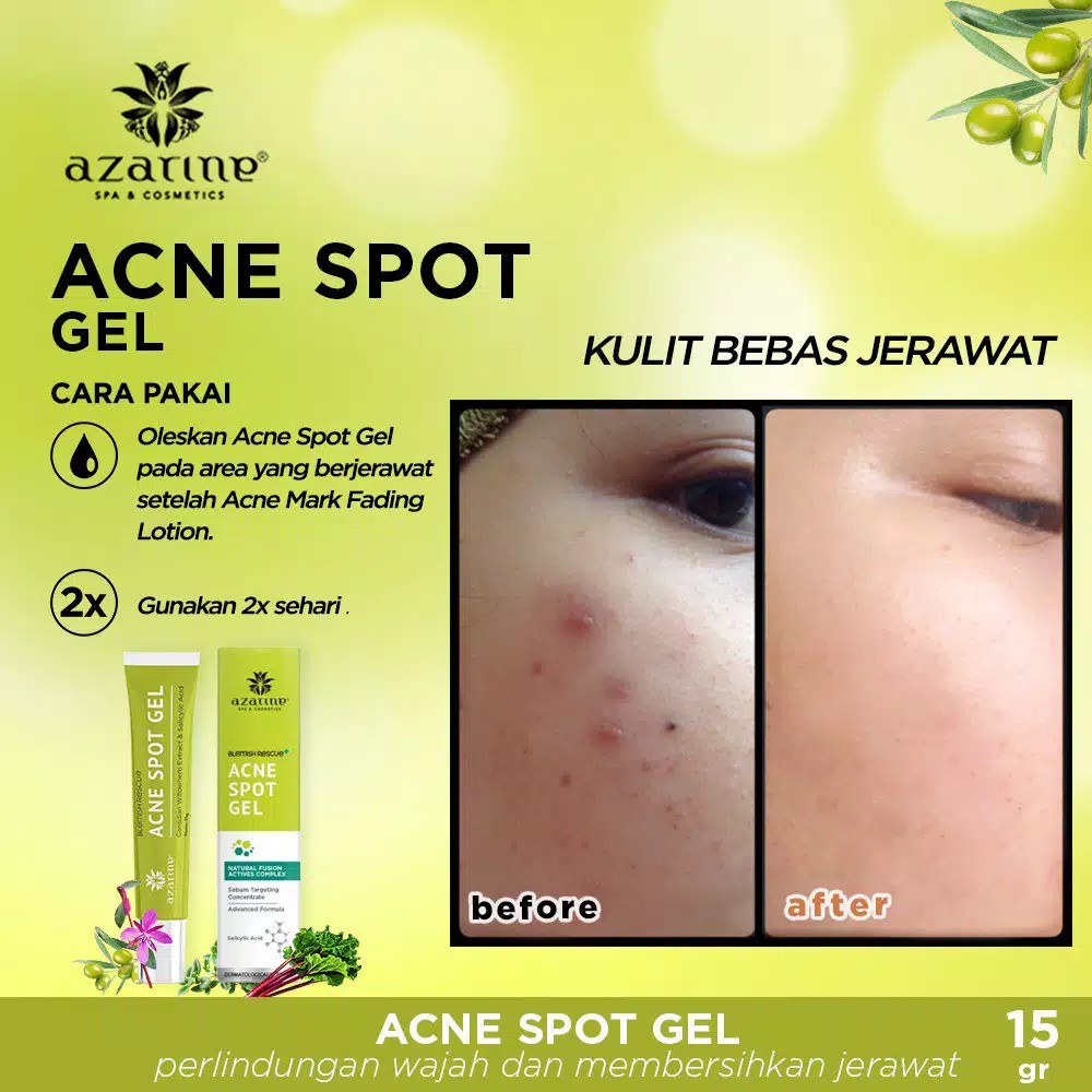 ANIMATE Acne Solution Series - Paket 5in1 / Ecer