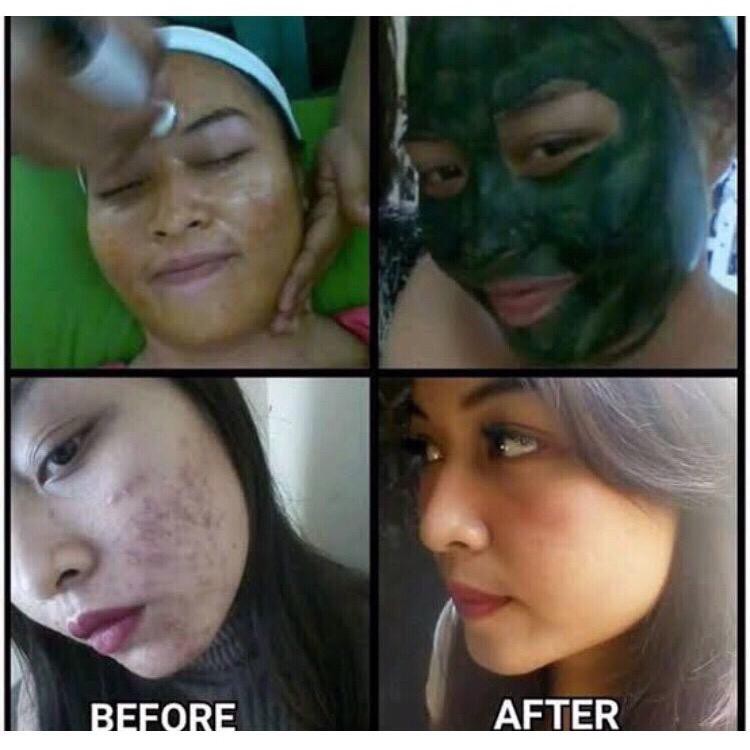 TERLARIS PAKET PREMIUM MASKER SPIRULINA BANYAK BONUSNYA