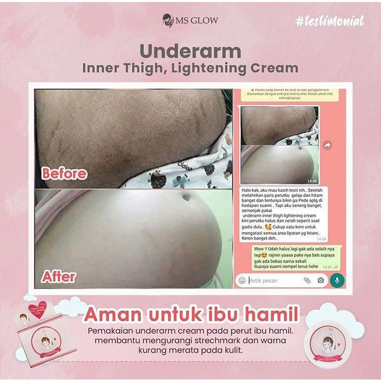 Ms Glow Underarm Ms Glow Original 100% Pemutih Ketiak Selangkangan Bokong Lip[Atan Tubuh Bpom