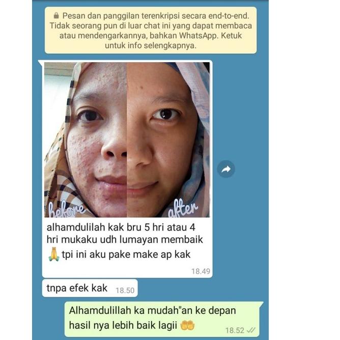 COD ADERA SERUM ORIGINAL FACE SERUM ADERA WAJAH ORI UNTUK FLEK HITAM GLOWING ORIGINAL BPOM ASLI 100%