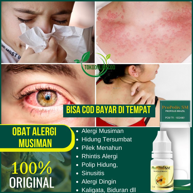 Obat Alergi Musiman, Hidung Tersumbat, Pilek Menahun, Rhinitis Alergi, Polip Hidung Sinusitis Herbal