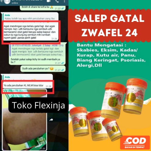 Obat 𝗦𝗔𝗟𝗘𝗣 𝗭𝗪𝗔𝗙𝗘𝗟 𝗡𝗨 𝟮𝟰 Belerang Sulfur 100 Original BPOM Salep Gatal Kutu Air Eksim Panu Kurap Biduran Gudik Scabies Psoriasis Kutil Mata ikan Jamur Ampuh