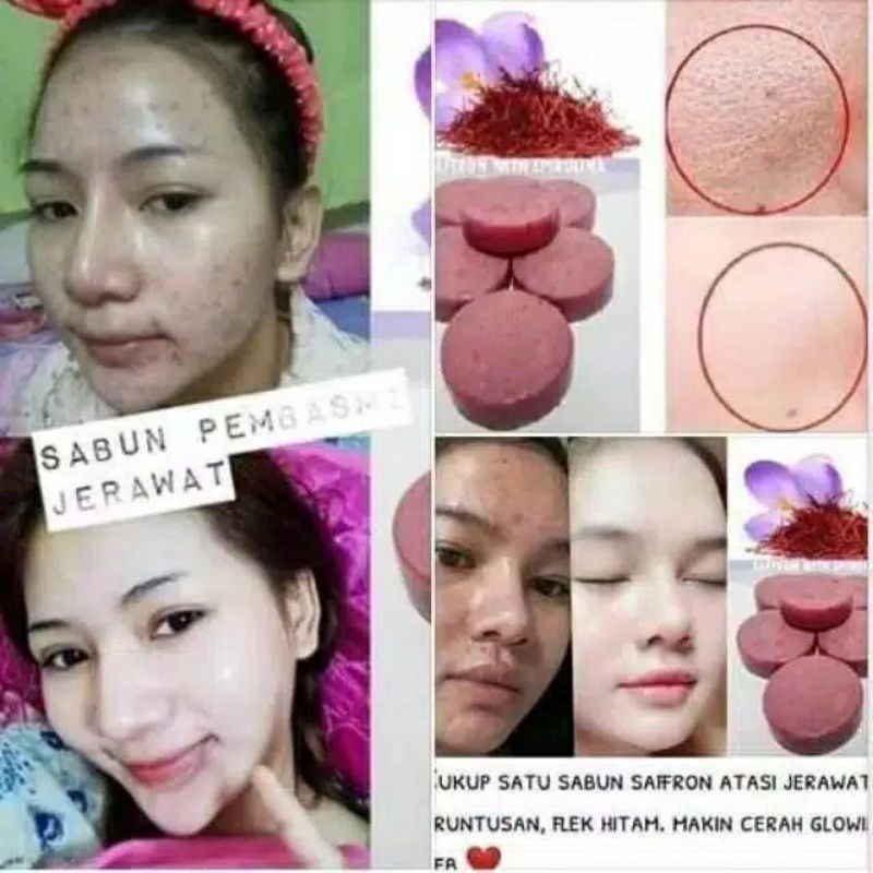 Sabun Saffron Murah | Sabun Saffron Pemutih | Sabun Saffron Penghilang Jerawat