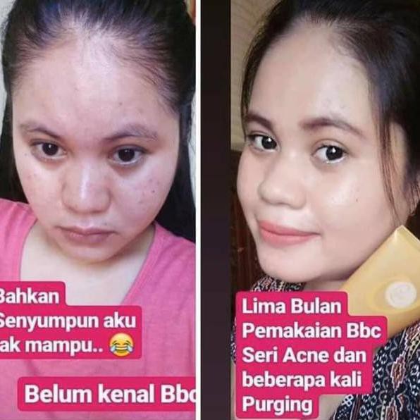 Murah banget BEBWHITE C ACNE SERIES / PAKET ACNE BBC / ORI / SKINCARE PENGHILANG JERAWAT E23R05 maka