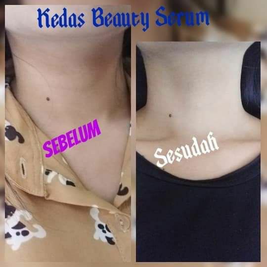 COD kedas beauty 100 % original brightening body serum pemutih badan BPOM kedas Body serum halall-5