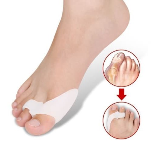 Silicone Gel Pelindung Bunion dan Pengurang Hallux Valgus 002