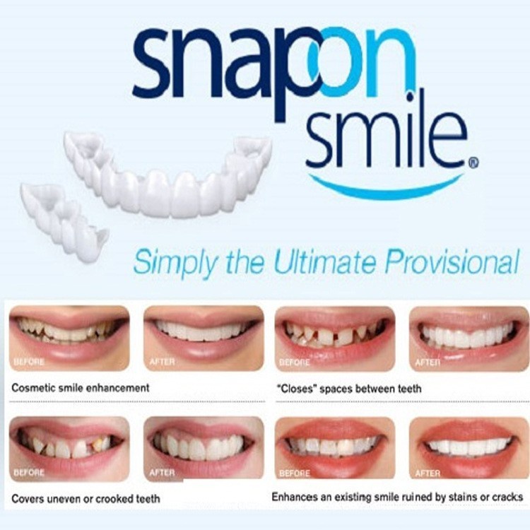 Snap On Smile 100% ORIGINAL Authentic Perawatan Kesehatan Gigi Palsu Renggang Snapon Smile 1 Set GROSIR