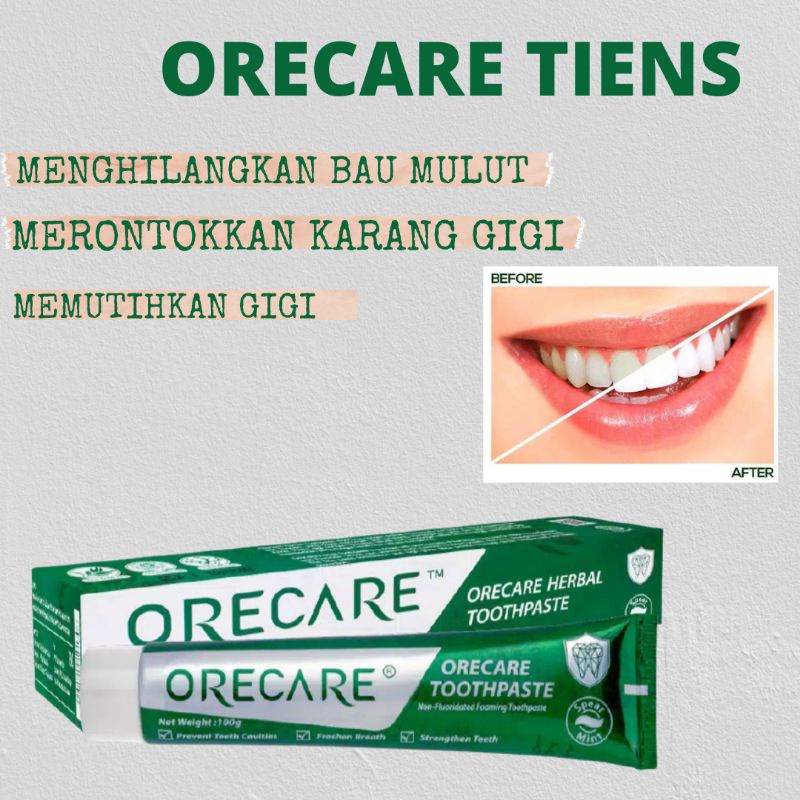 pemutih gigi || gigi || pemutih gigi permanen pemutih gigi permanen original  penghilang karang gigi