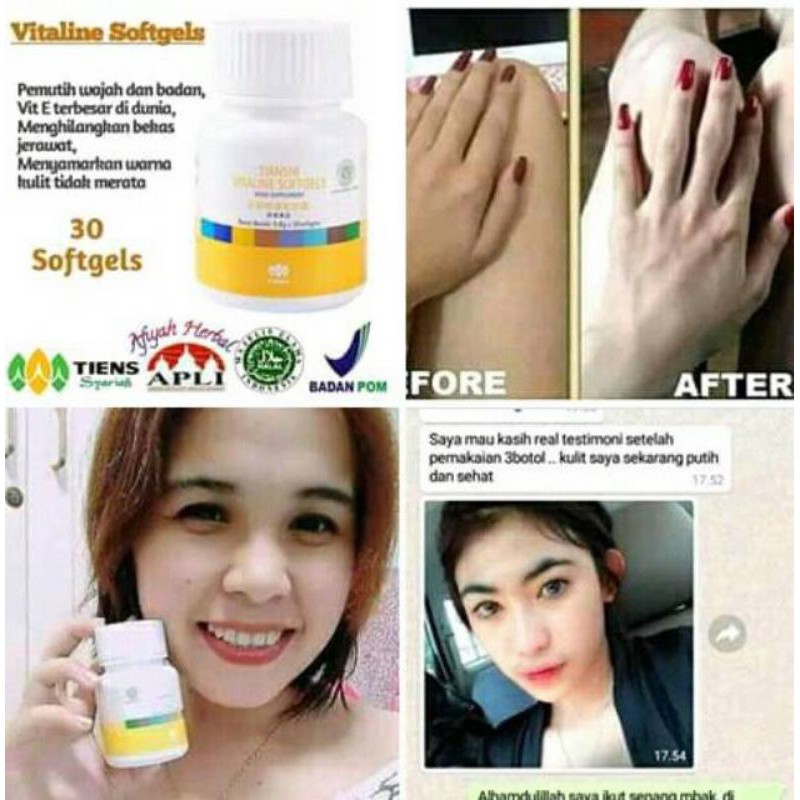 Vitaline softgels (pemutih badan) pemutih herbal terbaik di dunia 100%aman BPOM MUI