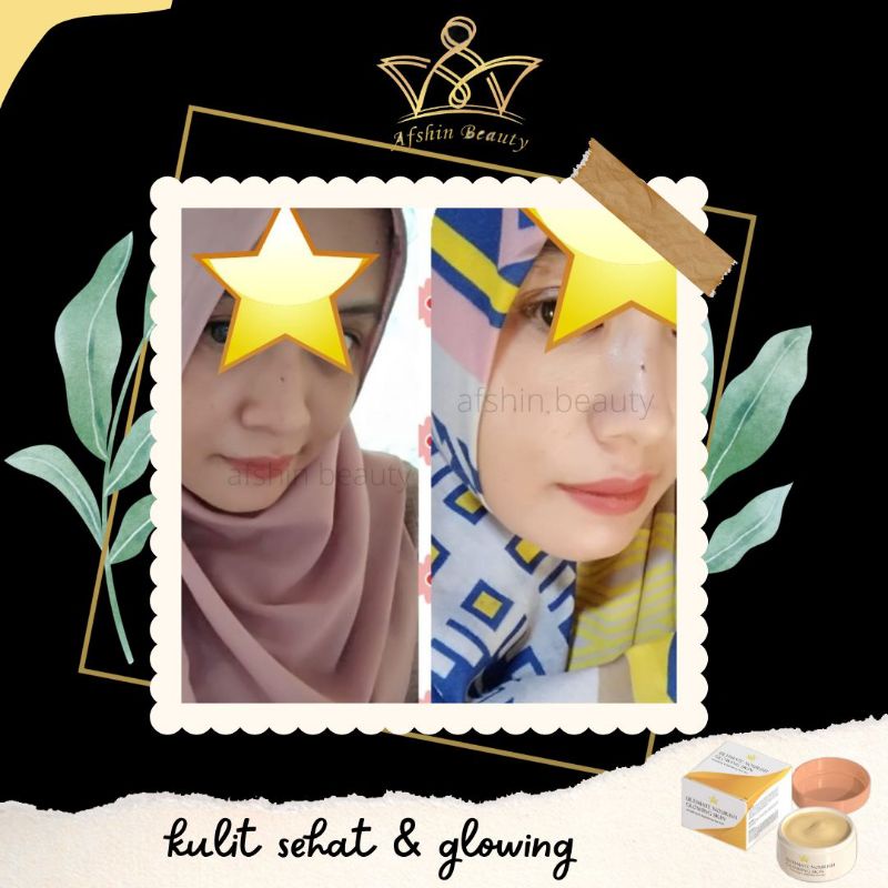 (READY) ULTIMATE NOURISH GLOWING SKIN BPOM (100% ORIGINAL) BIKIN PUTIH BERSIH GLOWING ULTIMATE NOURISH GLOWING SKIN CREAM GLOWING SKIN ORIGINAL / MENGATASI JERAWAT DAN MENGHILANGKAN BEKAS JERAWAT