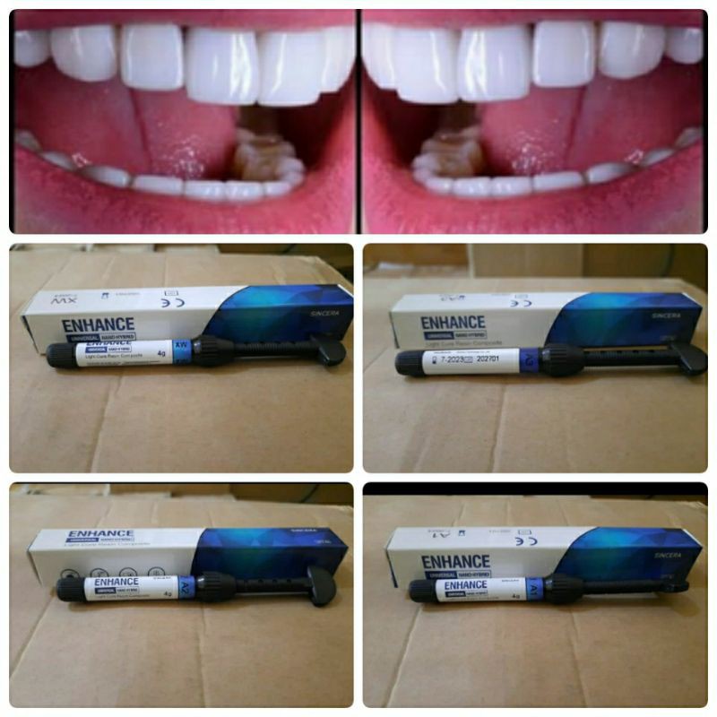 1 pcs Composite Sincera Xw, A1, A2, A3, Tambal Gigi Kelinci dan Veneer Gigi 4gram