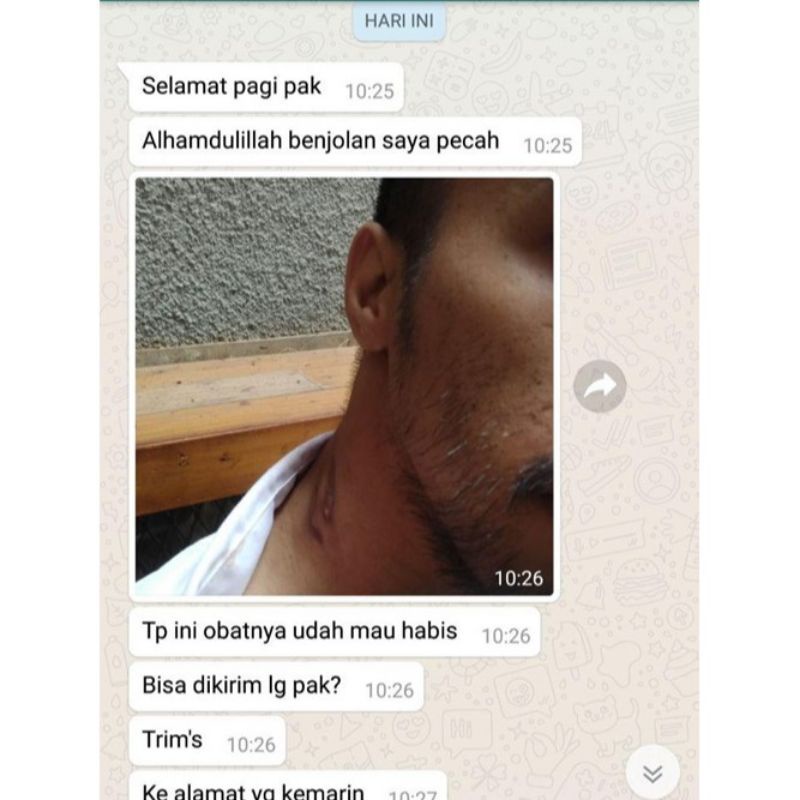 ( TERLARIS ) SALEP KHUSUS BENJOLAN AR-RAIHAN - MENGOBATI BENJOLAN - GONDOK - TUMOR _ obat kista. benjolan kista. Qahira. minyak Qahira. obat penghilang tiroid. obat tiroid. salep untuk tiroit. salep ampuh menghilangkan benjolan tiroit.