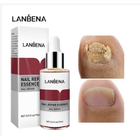Lanbena Nail Repair Essence Oil Serum Nail Treatment