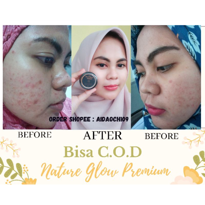 CREAM NATURE GLOW PREMIUM KRIM JERAWAT CREAM ACNE FLEK HITAM KRIM KULIT KUSAM CREAM AMAN BUMIL BUSUI