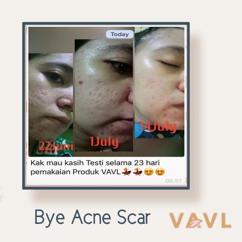 Vavl Beaute 1 Paket Package (Free pouch & gift)-5