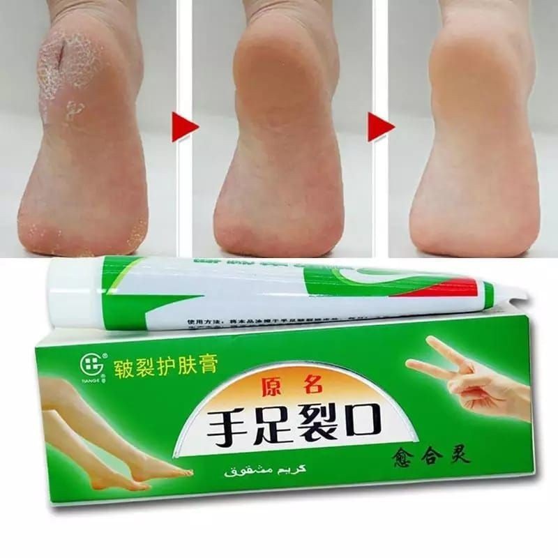 Hope Store - Salep Kapalan Ijo Salep Untuk Kaki Pecah Pecah Dan Kaki Kering Parah