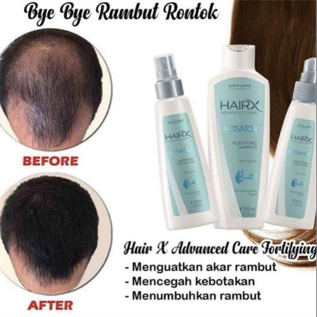 ORIFLAME HAIRX ADVANCE CARE 1 SET