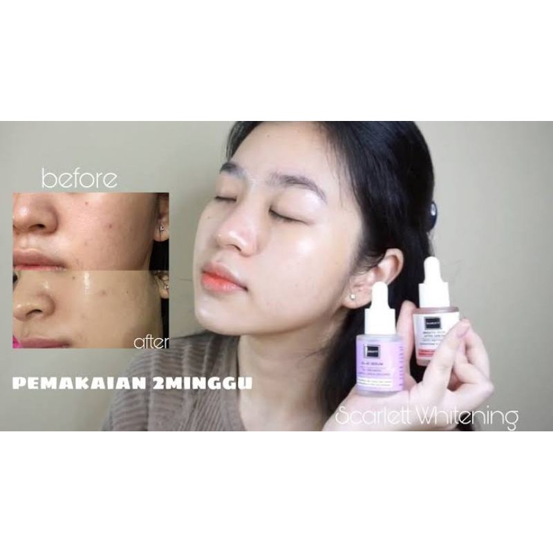 SCARLETT BRIGHTENING SERUM ACNE DAN SERUM BRIGHTLY - SCARLET BY FELICYA ANGELISTA