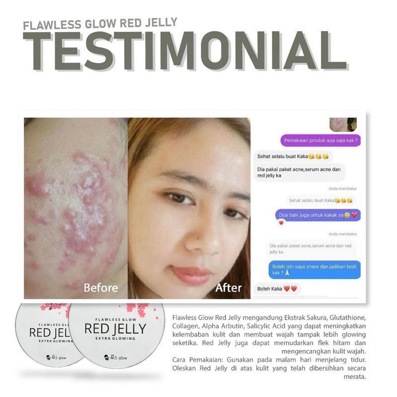 RED JELLY MSGLOW