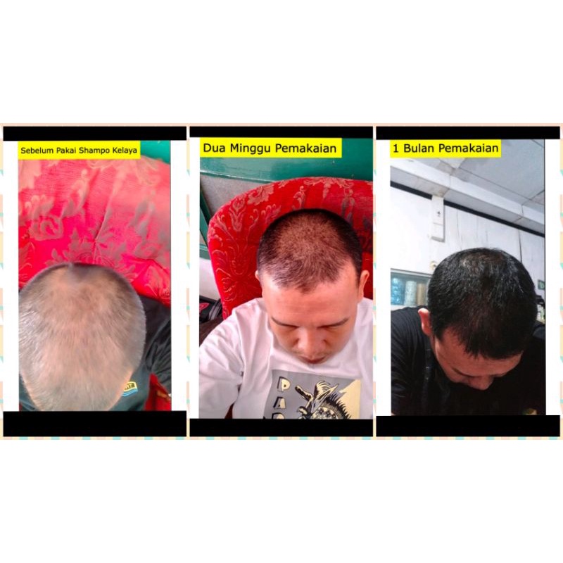 READY, Shampoo Kelaya Hair Treatment Ori 250ml Efektif Atasi Rambut Rontok, Botak, Rambut Tipis, Ketombe-4