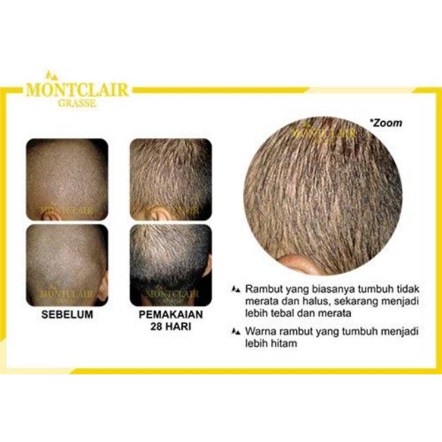 Montclair Hair Serum ORIGINAL 100% Penumbuh Rambut Bergaransi Best Seller Produk