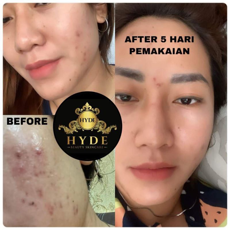 Hyde beauty skincare Facial Wash | Night Cream | Day Cream