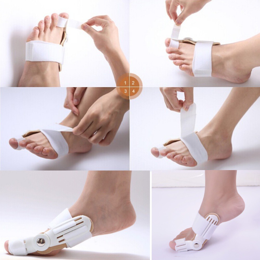 Korektor Hallux Valgus / Bunion / Alat Terapi / Kesehatan / Kecantikan / Olahraga / Medis / Alkes