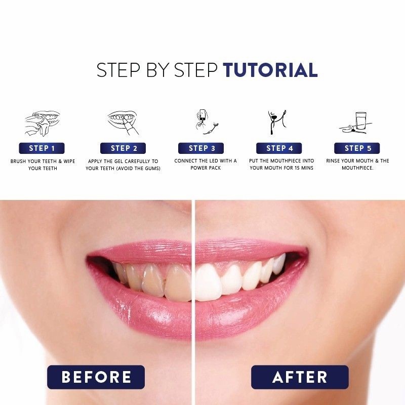 NEWLAB / Beaudelab Pen Refill Teeth Whitening | Pen Pasta Gel Isi Ulang untuk Alat pemutih Gigi Beau De Lab