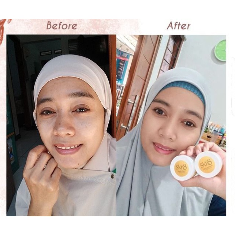 SKN8 Beauty Paket Skincare Lengkap Alami + Probiotik BPOM