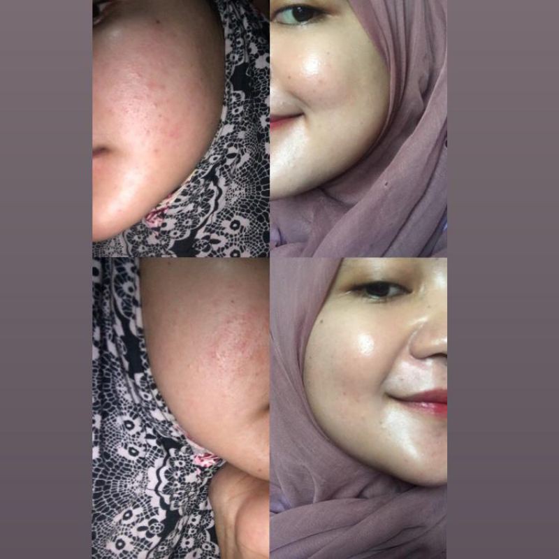 Day Cream Super Whitening Glowing