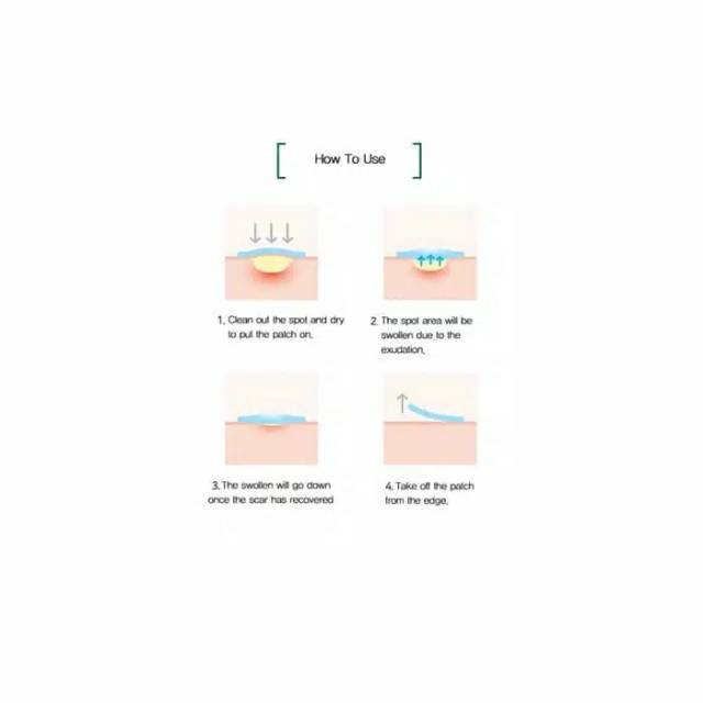 (Share 1pcs) SOME BY MI 30 Days Miracle Clear Spot Patch