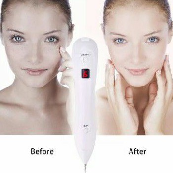 Alat Kecantikan Penghilang Tahi Lalat,Kutil Couter spot Teknologi cauter