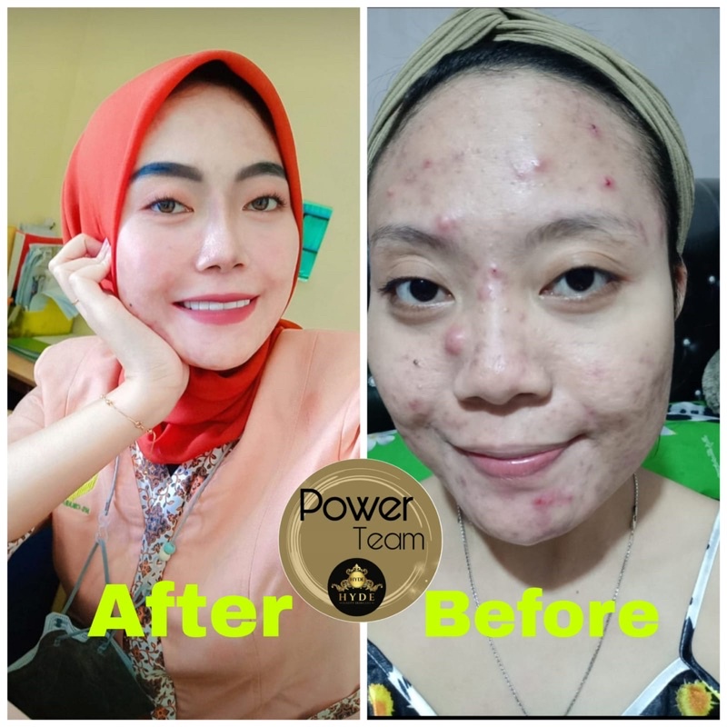 Hyde Beauty Skincare Paket Glowing isi 5