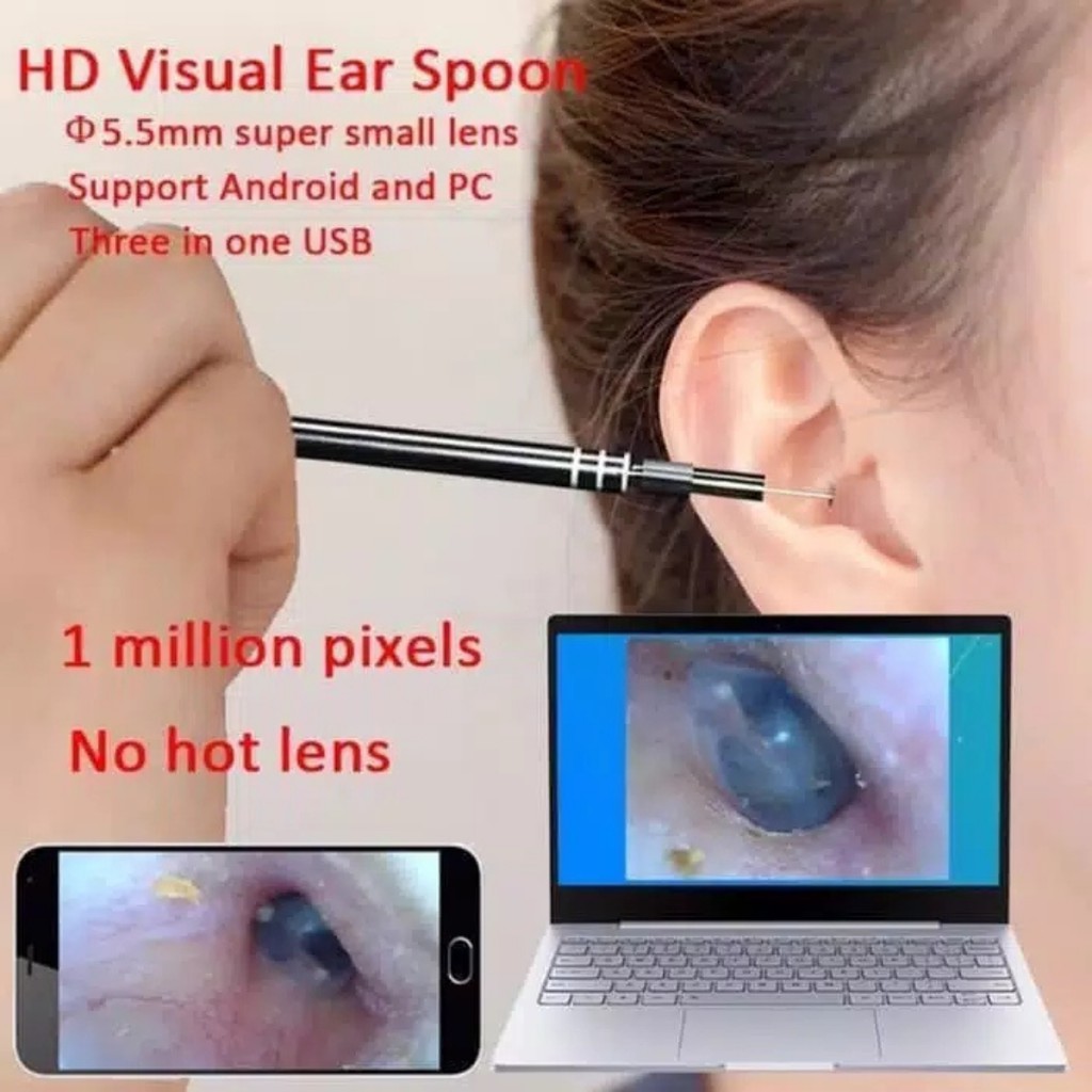 Kamera Endoscope HD Visual Earwax - Pembersih Telinga dengan Kamera