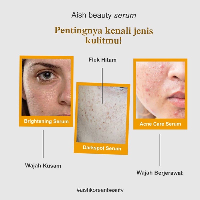 AISH SERUM DARK SPOT / Aish Serum Flek / Ais Serum Flek Hitam / aish serum korea / Drakspot AISH