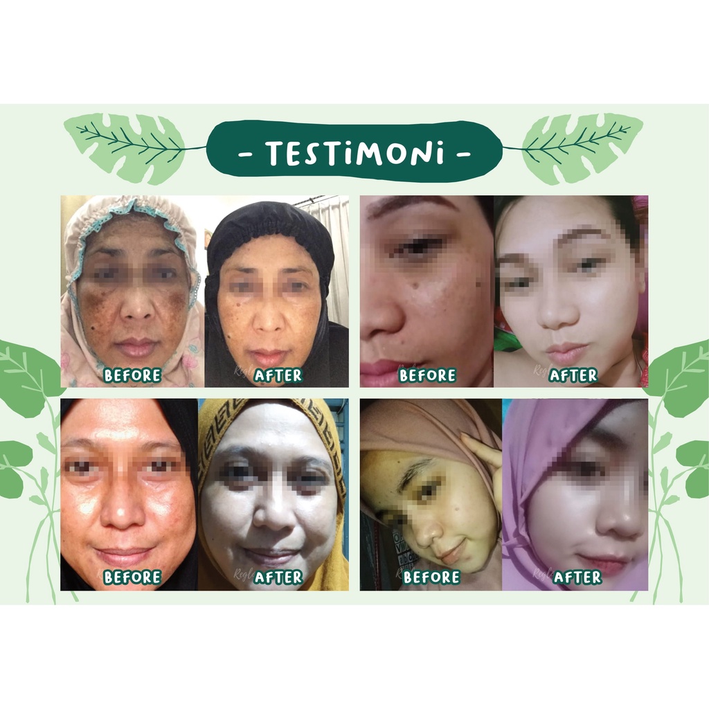 Reglow Paket Whitening Untuk Wajah Lebih putih dan Glowing