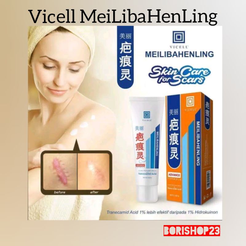 HANASUI VICELL SCAR TREATMENT CREAM 60gr