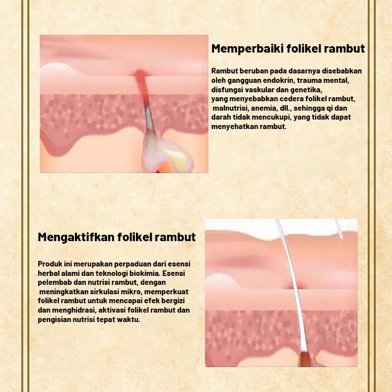 Pertumbuhan rambut Kondisioner fo-ti/Merawat rambut Serum Memperbaiki folikel rambut Cepat menumbuhkan rambut/Cairan jahe penumbuh rambut Rambut putih cepat menghitam Anti rambut rontok pria dan wanita