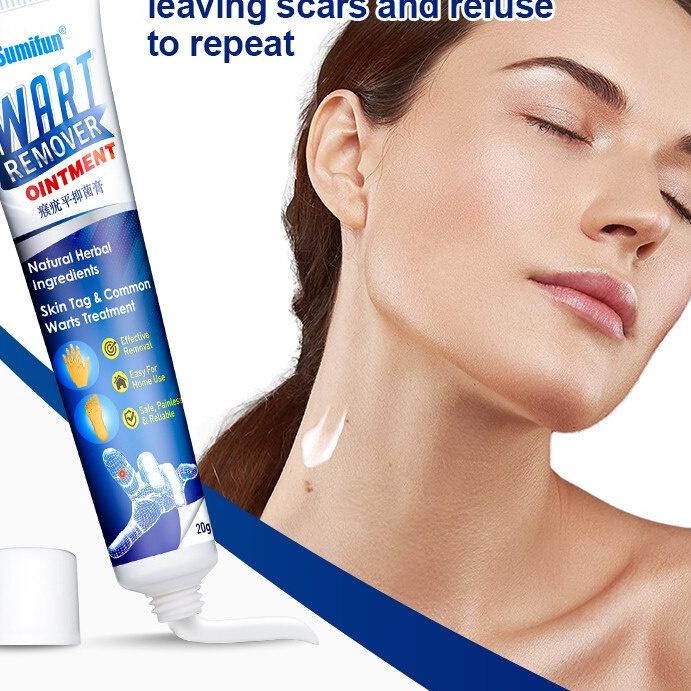 ☝ ORIGINAL Skin Tag Remover SUMIFUN Wart Remover Ointment | Penghilang Tahilalat ❋