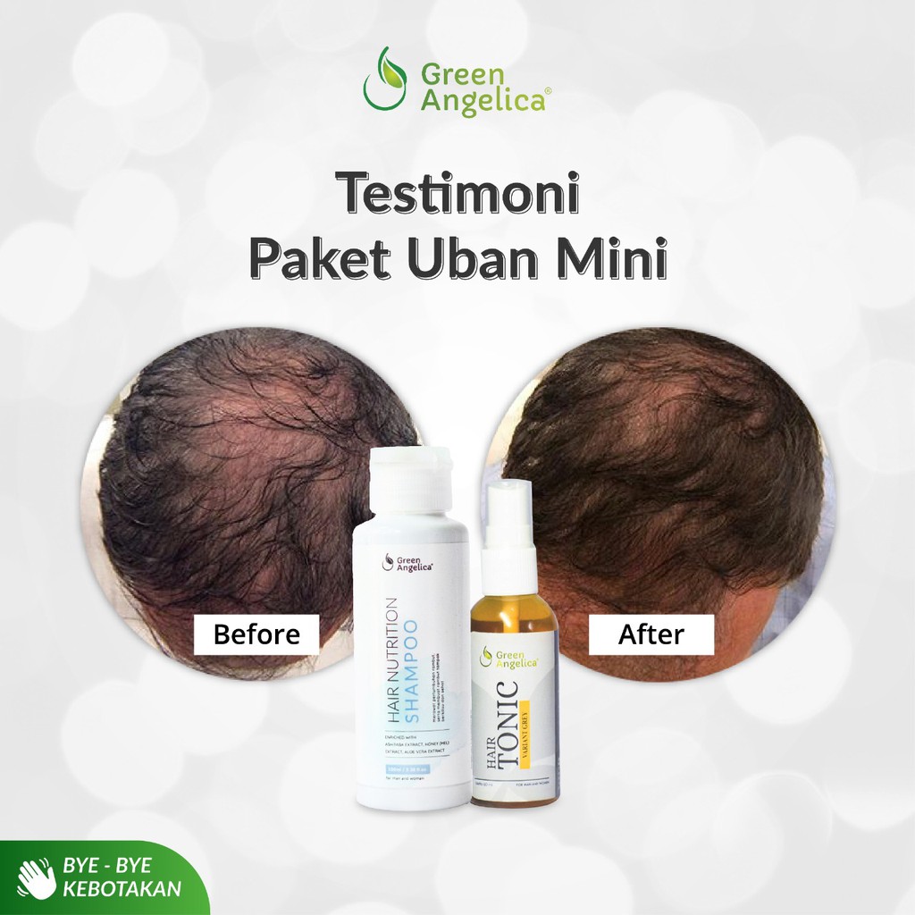 Penghitam Rambut Uban Permanen PENGHILANG UBAN TERAMPUH