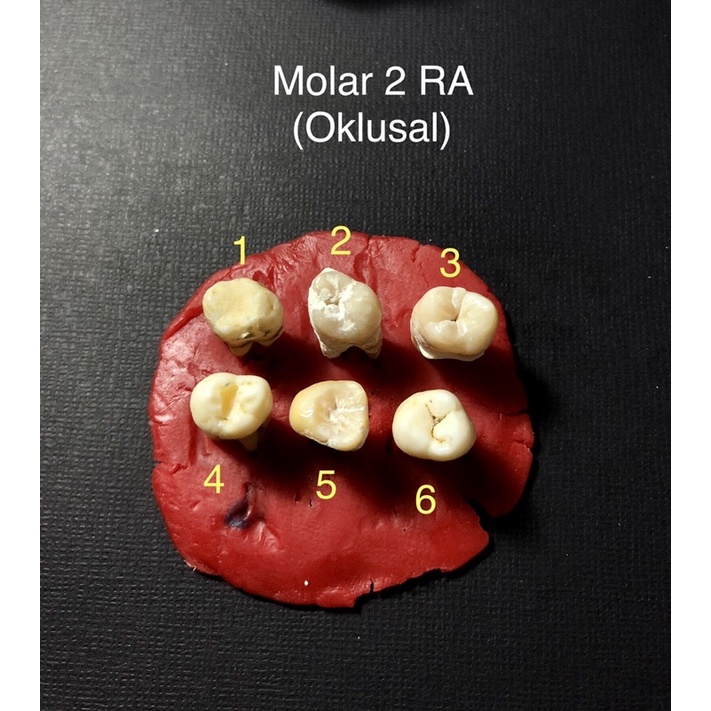 JUAL GIGI MOLAR 2 RA (GIGI ASLI PRAKTIKUM)