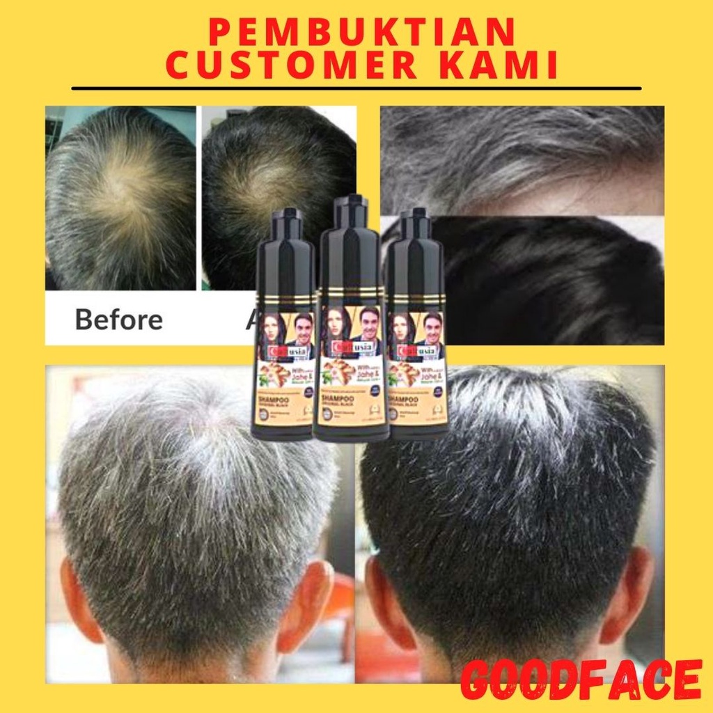 CULTUSIA SHAMPOO 160ML ORIGINAL BLACK - SHAMPO UBAN - PENGHILANG UBAN - SAMPO PENGHILANG UBAN