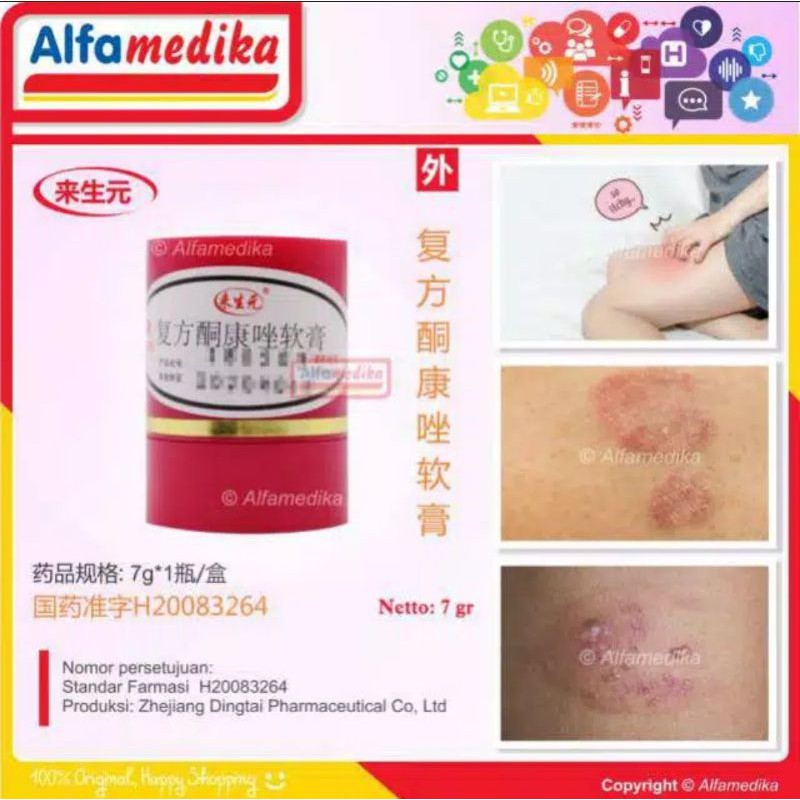 Salep / Cream Kulit Obat Gatal Cina Mengobati Panu Kadas Kudis Kurap Gudik Herpes Eksim Alergi