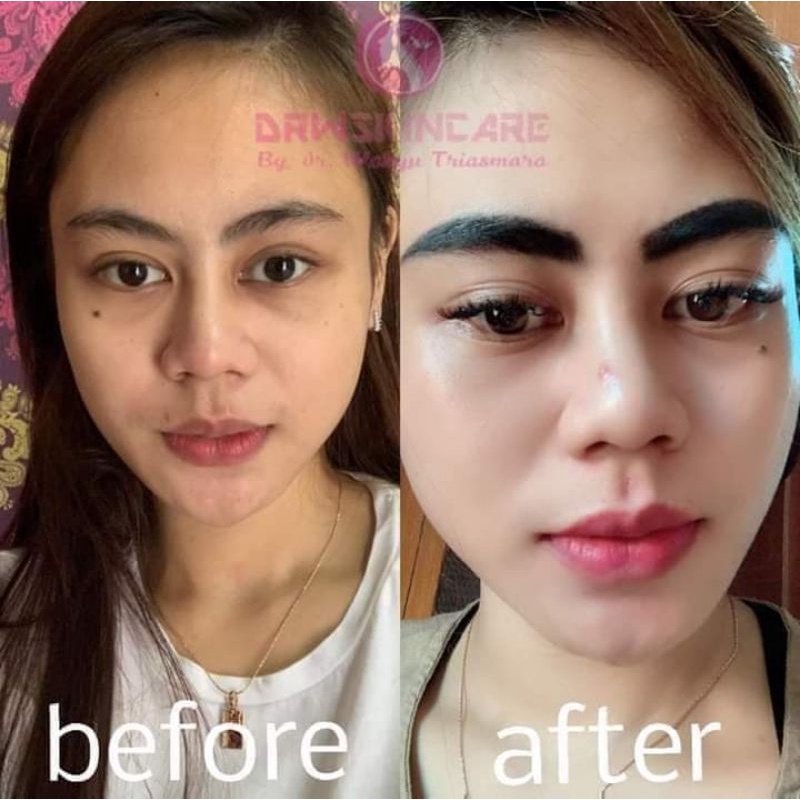 Paket Radiant Glow Drw Skincare/Cream Glowing/wajah Normal